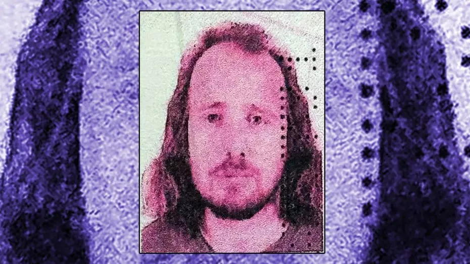 Hetim në Turqi pas vdekjes së një shqiptari pas operacionit estetik