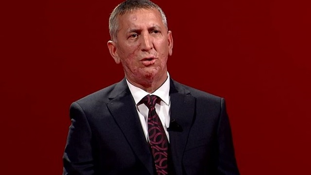 Anton Quni: Procesi i rinumërimit dëmton imazhin tim profesional