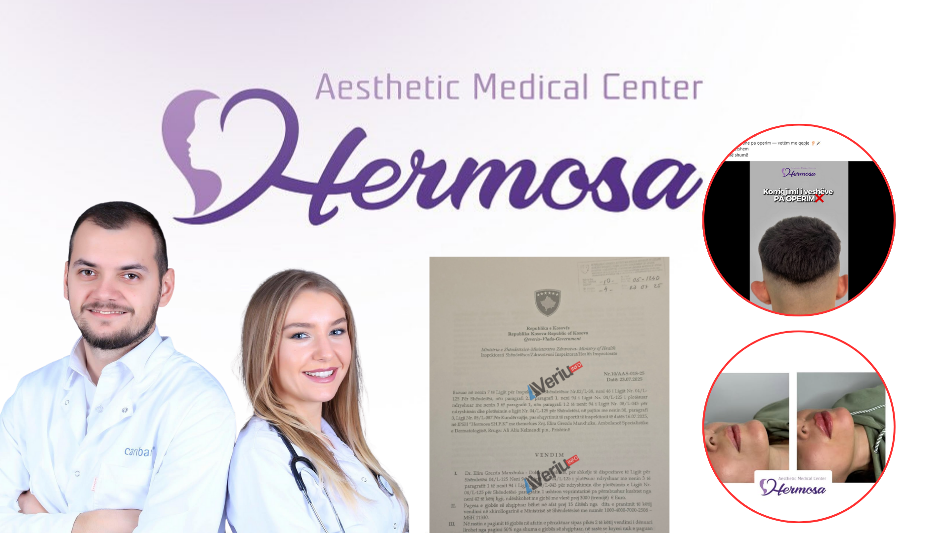 Klinika “Hermosa” gjobitet për shërbime pa licencë dermatologjike