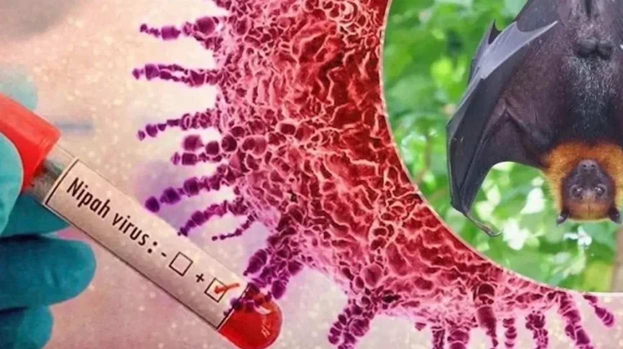 IKSHPK: Kosova përballet me rrezik të ulët nga virusi Nipah